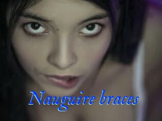 Nauguire_braces